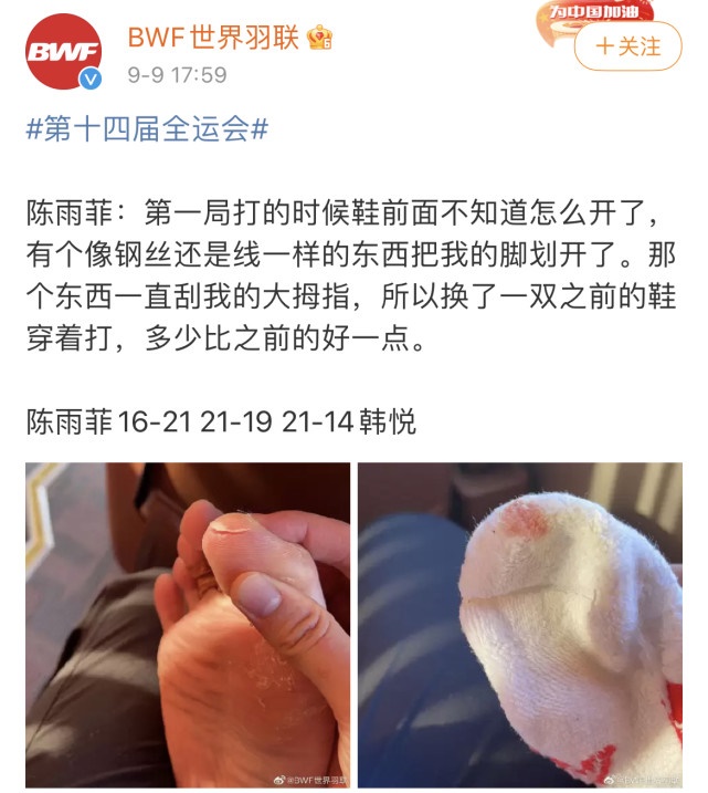AG现在很珍惜自己的羽毛，任何情况不会留下把柄遭人诟病(人不能太爱惜自己的羽毛)